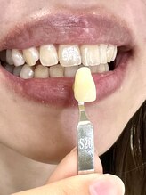 プラチナムビューティー 武蔵小山/ホワイトニング＋フェイシャル