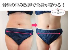 ヨンファテラピー 旗の台/before/after【旗の台/痩身】