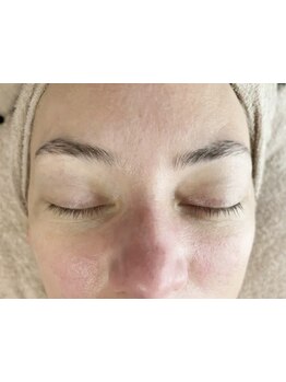 毛穴ケアをしたい