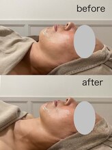 ミール(Meel)/【肩から上かスッキリ】