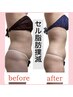 【セル脂肪撲滅★全身】40・50代向け引き締めダイエット！平均－8kg☆LL→Mへ