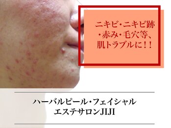 エステサロン ジジ 新宿(JIJI)