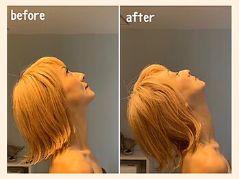 ラフリー 天神赤坂院(RUFFREE)/首の可動域にも変化【天神赤坂】