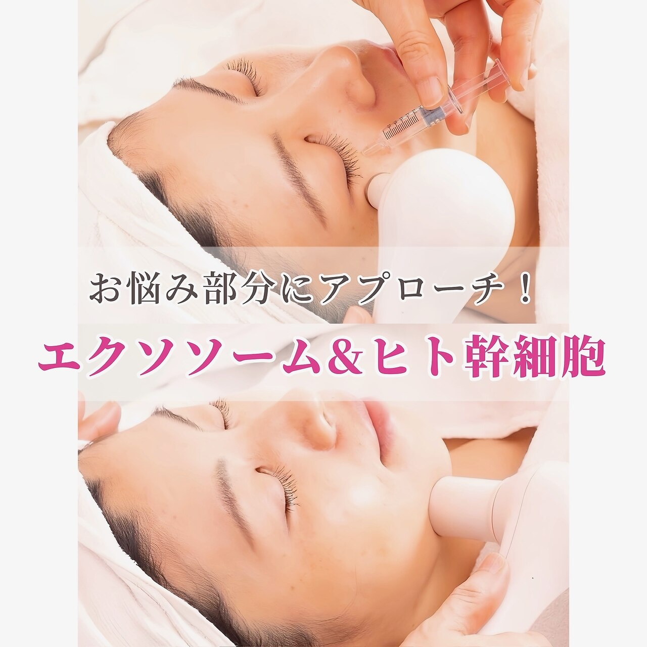 ビオトナス(Facial Esthe)｜ホットペッパービューティー