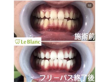 ルブラン 奈良店(Le Blanc)/メリットしかない!