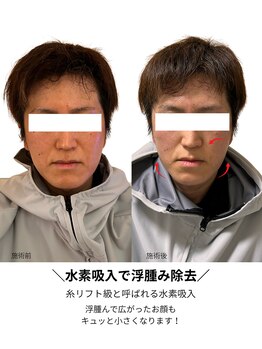 ヨサパーク サノン(YOSA PARK Sanon)/男性も紹介で来店可能