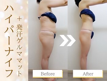 グレースフル/Before&After