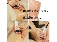 コンフォート爽快(COMFORT爽快)の雰囲気（大人気の痩身ケア！一度でもスッキリ感が味わえます♪）