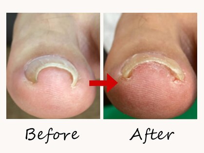 一宮巻き爪センターの写真