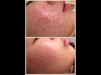 スリリアン 銀座/★お客さまビフォーアフター★