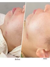 ビジ(biji)/トラブル肌も健やかに