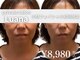ルアナ(Luana)の写真