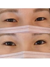 プライベイトスペース コト(PRIVATE SPACE COTO)/アイストレッチ