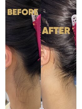 ピリナ(Pilina)/えり剃り