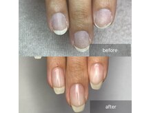 ユイネイル(結Nail)の雰囲気（オススメ☆自爪育成メニュー　爪のお悩みお任せ下さい）