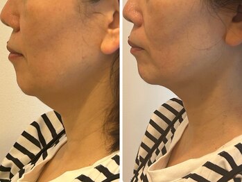 グラサヴォーグ 金沢店/パイラブラッシュリフレであがる