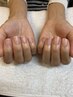 【爪用美容液ホームケア付◇】美爪トリートメントケア<爪用美容液付> ¥9,950