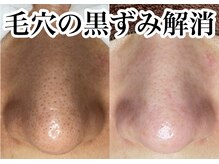 アンドピエル(AndPiel)/是非ご覧ください^ ^
