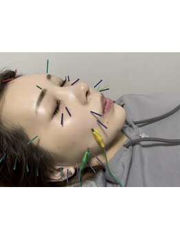 小顔になりたい