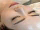 イセラ(ISELA)の写真/【7月NEW OPEN♪】韓国美容をパスポート無で渡韓せず国内で受けれるリジュラン肌育♪自分史上最高の素肌へ
