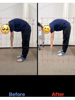 美田園5丁目接骨院/下半身ストレッチbefore⇒after