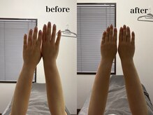 ベール(BEHL)/コルギのBefore After