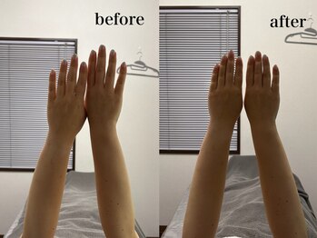 ベール(BEHL)/コルギのBefore After