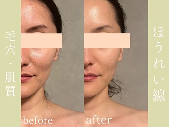 健志接骨院/πテラピー造顔メソッド