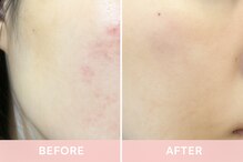 パシュート(pursuit)