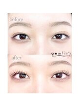 アンフィズム(annfism)/