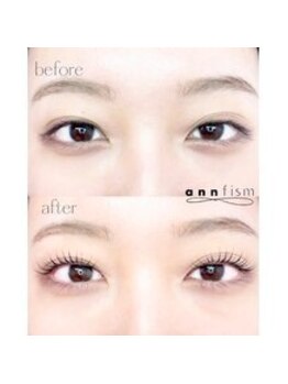 アンフィズム(annfism)/