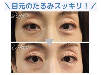 キラリ(Kirari)の写真