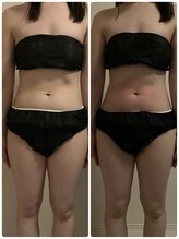 クー(9 Kuu)/痩身◇フォースカッター初回効果