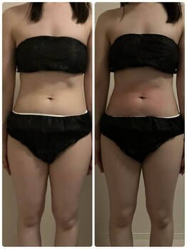 クー(9 Kuu)/痩身◇フォースカッター初回効果