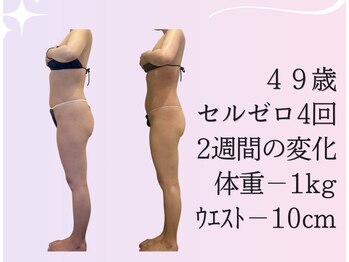 ムーン 高崎店(MOON)/2週間でこの変化