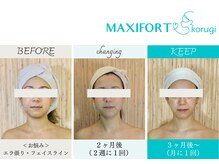 マキシフォート 名駅店(Maxifort)/驚きのビフォーアフター◎