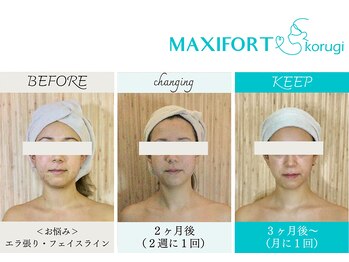 マキシフォート 名駅店(Maxifort)/驚きのビフォーアフター◎