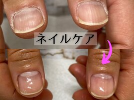 地爪ネイルケア