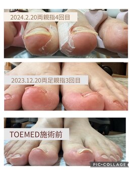 ブロックファイブハナ(Block 5 HANA)/