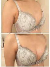 エスビューティー 三軒茶屋(S beauty)/バストケア・池尻大橋・痩身