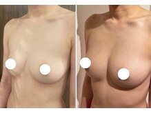 エスビューティー 三軒茶屋(S beauty)/バストケア・世田谷・痩身