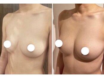 エスビューティー 三軒茶屋(S beauty)/バストケア・世田谷・痩身