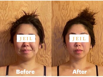 チェイル(JEIL)/小顔コルギ