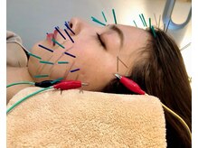 セルフィット鍼灸整骨院の雰囲気（美容鍼については【ブログ】【フォトギャラリー】をご覧下さい☆）