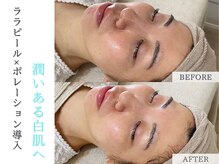 プルチャームエクイデム(Pulchram equidem)/ララピール+導入でうるツヤ肌へ