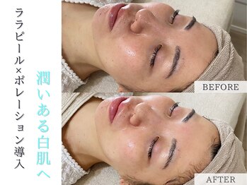 プルチャームエクイデム(Pulchram equidem)/ララピール+導入でうるツヤ肌へ