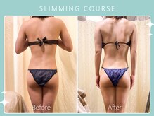 ハノハノ 八代店(HANO HANO)/選べる12種の痩身脂肪撃退☆