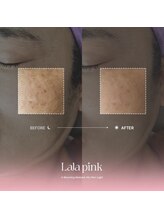 カルム(Calme)/Lalapink