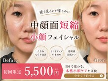 ソワラ 札幌
