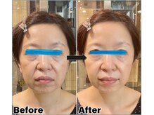 整顔院 学芸大学店/